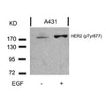 Western blot analysis of extracts from A431 cells untreated or treated with EGF using HER2(Phospho-Tyr877) Antibody.