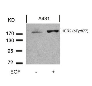 Western blot analysis of extracts from A431 cells untreated or treated with EGF using HER2(Phospho-Tyr877) Antibody.