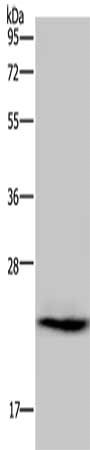 Gel: 10%SDS-PAGE, Lysate: 40 ug, Lane: Human fetal muscle tissue, Primary antibody: CSB-PA846739(AK1 Antibody) at dilution 1/200, Secondary antibody: Goat anti rabbit IgG at 1/8000 dilution, Exposure time: 10 seconds