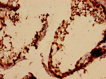 Immunohistochemistry analysis of human testis tissue using CSB-PA847209HA01HU at dilution of 1:100