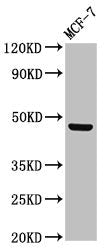 Western Blot
Positive WB detected in: MCF-7 whole cell lysate
All lanes: CERS5 antibody at 3µg/ml
Secondary
Goat polyclonal to rabbit IgG at 1/50000 dilution
Predicted band size: 46, 40 kDa
Observed band size: 46 kDa