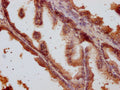 IHC image of CSB-PA847661LA01HU diluted at 1:500 and staining in paraffin-embedded human prostate tissue performed on a Leica BondTM system. After dewaxing and hydration, antigen retrieval was mediated by high pressure in a citrate buffer (pH 6.0). Section was blocked with 10% normal goat serum 30min at RT. Then primary antibody (1% BSA) was incubated at 4°C overnight. The primary is detected by a Goat anti-rabbit IgG labeled by HRP and visualized using 0.05% DAB.