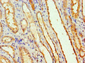 Immunohistochemistry of paraffin-embedded human kidney tissue using CSB-PA847682ESR1HU at dilution of 1:100