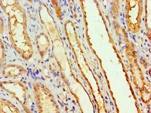 Immunohistochemistry of paraffin-embedded human kidney tissue using CSB-PA847682ESR1HU at dilution of 1:100