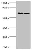 Western blot
All lanes: Myotubularin-related protein 14 antibody at 10ug/ml
Lane 1: Hela whole cell lysate
Lane 2: Mouse skeletal muscle tissue
Secondary
Goat polyclonal to rabbit IgG at 1/10000 dilution
Predicted band size: 73, 67, 61 kDa
Observed band size: 73 kDa