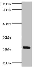 Western blot All lanes: IL27 antibody at 2ug/ml + Mouse liver tissue Secondary Goat polyclonal to rabbit IgG at 1/10000 dilution Predicted band size: 27 kDa Observed band size: 27 kDa