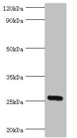 Western blot All lanes: IL27 antibody at 2ug/ml + Mouse liver tissue Secondary Goat polyclonal to rabbit IgG at 1/10000 dilution Predicted band size: 27 kDa Observed band size: 27 kDa