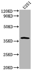 Western Blot
Positive WB detected in: U251 whole cell lysate
All lanes: OR6B3 antibody at 1:2000
Secondary
Goat polyclonal to rabbit IgG at 1/50000 dilution
Predicted band size: 38 kDa
Observed band size: 38 kDa