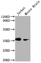 Western Blot
Positive WB detected in: Jurkat whole cell lysate, Mouse Brain tissue
All lanes: OR51F2 antibody at 1:2000
Secondary
Goat polyclonal to rabbit IgG at 1/50000 dilution
Predicted band size: 39 kDa
Observed band size: 39 kDa