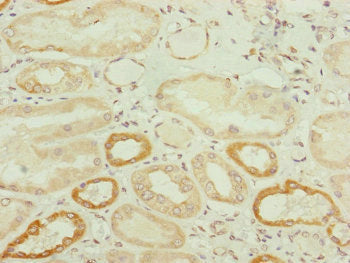 TWIST2 Antibody – Figure 1 of 3