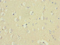 Immunohistochemistry of paraffin-embedded human brain tissue using CSB-PA850248ESR1HU at dilution of 1:100