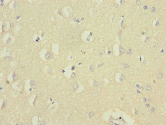 Immunohistochemistry of paraffin-embedded human brain tissue using CSB-PA850248ESR1HU at dilution of 1:100