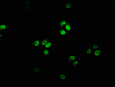 Immunofluorescence staining of HepG2 cells with CSB-PA850403LA01HU at 1:66, counter-stained with DAPI. The cells were fixed in 4% formaldehyde, permeabilized using 0.2% Triton X-100 and blocked in 10% normal Goat Serum. The cells were then incubated with the antibody overnight at 4°C. The secondary antibody was Alexa Fluor 488-congugated AffiniPure Goat Anti-Rabbit IgG(H+L).