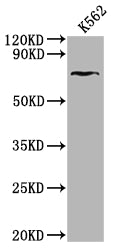 Western Blot
Positive WB detected in: K562 whole cell lysate
All lanes: HHIP antibody at 1:2000
Secondary
Goat polyclonal to rabbit IgG at 1/50000 dilution
Predicted band size: 79, 37 kDa
Observed band size: 79 kDa