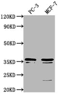Western Blot
Positive WB detected in: PC-3 whole cell lysate, MCF-7 whole cell lysate
All lanes: OR6C1 antibody at 1:1000
Secondary
Goat polyclonal to rabbit IgG at 1/50000 dilution
Predicted band size: 36 kDa
Observed band size: 36 kDa