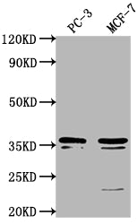 Western Blot
Positive WB detected in: PC-3 whole cell lysate, MCF-7 whole cell lysate
All lanes: OR6C1 antibody at 1:1000
Secondary
Goat polyclonal to rabbit IgG at 1/50000 dilution
Predicted band size: 36 kDa
Observed band size: 36 kDa