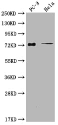 Western Blot
Positive WB detected in: PC-3 whole cell lysate, Hela whole cell lysate
All lanes: GLB1L3 antibody at 1:2000
Secondary
Goat polyclonal to rabbit IgG at 1/50000 dilution
Predicted band size: 75, 36 kDa
Observed band size: 75 kDa