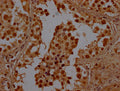 IHC image of CSB-PA850867LA01HU diluted at 1:100 and staining in paraffin-embedded human testis tissue performed on a Leica BondTM system. After dewaxing and hydration, antigen retrieval was mediated by high pressure in a citrate buffer (pH 6.0). Section was blocked with 10% normal goat serum 30min at RT. Then primary antibody (1% BSA) was incubated at 4°C overnight. The primary is detected by a Goat anti-rabbit polymer IgG labeled by HRP and visualized using 0.05% DAB.