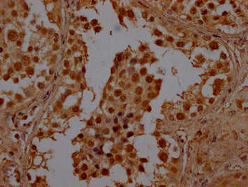 IHC image of CSB-PA850867LA01HU diluted at 1:100 and staining in paraffin-embedded human testis tissue performed on a Leica BondTM system. After dewaxing and hydration, antigen retrieval was mediated by high pressure in a citrate buffer (pH 6.0). Section was blocked with 10% normal goat serum 30min at RT. Then primary antibody (1% BSA) was incubated at 4°C overnight. The primary is detected by a Goat anti-rabbit polymer IgG labeled by HRP and visualized using 0.05% DAB.