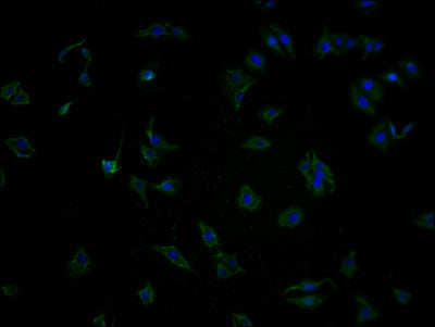 Immunofluorescence staining of HepG2 cells with CSB-PA850889NA01HU at 1:100, counter-stained with DAPI. The cells were fixed in 4% formaldehyde and blocked in 10% normal Goat Serum. The cells were then incubated with the antibody overnight at 4°C. The secondary antibody was Alexa Fluor 488-congugated AffiniPure Goat Anti-Rabbit IgG(H+L).