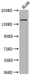 Western Blot
Positive WB detected in: HL60 whole cell lysate
All lanes: SMARCC2 antibody at 1:2000
Secondary
Goat polyclonal to rabbit IgG at 1/50000 dilution
Predicted band size: 133, 125, 127 kDa
Observed band size: 170 kDa