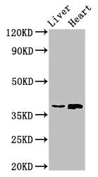 Western Blot
Positive WB detected in: Rat liver tissue, Rat heart tissue
All lanes: ACMSD antibody at 4ug/ml
Secondary
Goat polyclonal to rabbit IgG at 1/50000 dilution
Predicted band size: 39, 32 kDa
Observed band size: 39 kDa