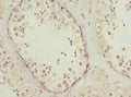Immunohistochemistry of paraffin-embedded human testis tissue using CSB-PA852884ESR1HU at dilution of 1:100