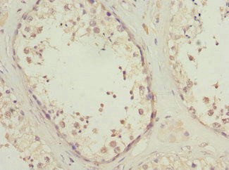 Immunohistochemistry of paraffin-embedded human testis tissue using CSB-PA852884ESR1HU at dilution of 1:100