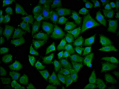 Immunofluorescence staining of Hela cells with CSB-PA853375LA01HU at 1:133, counter-stained with DAPI. The cells were fixed in 4% formaldehyde, permeabilized using 0.2% Triton X-100 and blocked in 10% normal Goat Serum. The cells were then incubated with the antibody overnight at 4°C. The secondary antibody was Alexa Fluor 488-congugated AffiniPure Goat Anti-Rabbit IgG(H+L).