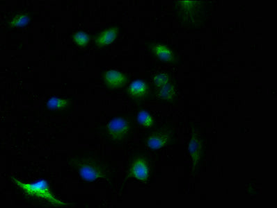 Immunofluorescence staining of U251 cells with CSB-PA853391LA01HU at 1:100, counter-stained with DAPI. The cells were fixed in 4% formaldehyde, permeabilized using 0.2% Triton X-100 and blocked in 10% normal Goat Serum. The cells were then incubated with the antibody overnight at 4°C. The secondary antibody was Alexa Fluor 488-congugated AffiniPure Goat Anti-Rabbit IgG(H+L).