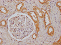 IHC image of CSB-PA853393LA01HU diluted at 1:100 and staining in paraffin-embedded human kidney tissue performed on a Leica BondTM system. After dewaxing and hydration, antigen retrieval was mediated by high pressure in a citrate buffer (pH 6.0). Section was blocked with 10% normal goat serum 30min at RT. Then primary antibody (1% BSA) was incubated at 4°C overnight. The primary is detected by a Goat anti-rabbit IgG labeled by HRP and visualized using 0.05% DAB.