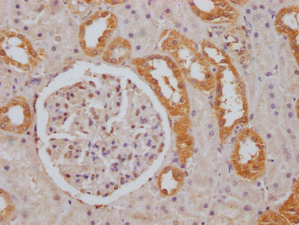 IHC image of CSB-PA853393LA01HU diluted at 1:100 and staining in paraffin-embedded human kidney tissue performed on a Leica BondTM system. After dewaxing and hydration, antigen retrieval was mediated by high pressure in a citrate buffer (pH 6.0). Section was blocked with 10% normal goat serum 30min at RT. Then primary antibody (1% BSA) was incubated at 4°C overnight. The primary is detected by a Goat anti-rabbit IgG labeled by HRP and visualized using 0.05% DAB.