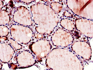 Immunohistochemistry of paraffin-embedded human thyroid tissue using CSB-PA853397LA01HU at dilution of 1:100