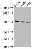 Western Blot
Positive WB detected in: Hela whole cell lysate, A549 whole cell lysate, PC-3 whole cell lysate
All lanes: ALS2CR12 antibody at 12µg/ml
Secondary
Goat polyclonal to rabbit IgG at 1/50000 dilution
Predicted band size: 53, 50 kDa
Observed band size: 53 kDa