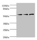 Western blot All lanes: ACVR1C antibody at 4ug/ml Lane 1: Mouse brain tissue Lane 2: HepG2 whole cell lysate Lane 3: Hela whole cell lysate Secondary Goat polyclonal to rabbit IgG at 1/10000 dilution Predicted band size: 55, 38, 47, 50 kDa Observed band size: 55 kDa