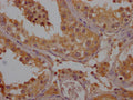 IHC image of CSB-PA854129OA01HU diluted at 1:200 and staining in paraffin-embedded human testis tissue performed on a Leica BondTM system. After dewaxing and hydration, antigen retrieval was mediated by high pressure in a citrate buffer (pH 6.0). Section was blocked with 10% normal goat serum 30min at RT. Then primary antibody (1% BSA) was incubated at 4°C overnight. The primary is detected by a Goat anti-rabbit polymer IgG labeled by HRP and visualized using 0.05% DAB.