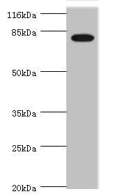 Western blot
All lanes: IL31RA antibody at 1.45ug/ml + Mouse kidney tissue
Secondary
Goat polyclonal to rabbit IgG at 1/10000 dilution
Predicted band size: 83, 87, 75, 42, 78, 71, 59, 67, 64, 70, 85 kDa
Observed band size: 83 kDa