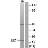 Western blot analysis of extracts from HeLa cells, using EID1 antibody.