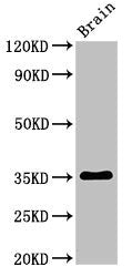 Western Blot
Positive WB detected in: Rat brain tissue
All lanes: Metrnl antibody at 3ug/ml
Secondary
Goat polyclonal to rabbit IgG at 1/50000 dilution
Predicted band size: 35, 36 kDa
Observed band size: 35 kDa