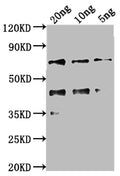 Western Blot
Positive WB detected in Recombinant protein
All lanes: kaiC antibody at 1:2000
Secondary
Goat polyclonal to rabbit IgG at 1/50000 dilution
Predicted band size: 56.8 kDa
Observed band size: 69 kDa