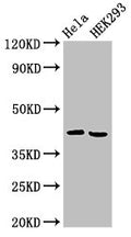 Western Blot
Positive WB detected in: Hela whole cell lysate, HEK293 whole cell lysate
All lanes: ARPC1A antibody at 4ug/ml
Secondary
Goat polyclonal to rabbit IgG at 1/50000 dilution
Predicted band size: 42, 39 kDa
Observed band size: 42 kDa