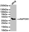 Western Blot
Positive WB detected in: recombinant protein
All lanes: RAPTOR1 Antibody at 1:1000
Secondary
Goat polyclonal to rabbit IgG at 1/50000 dilution
Predicted band size: 46 kDa
Observed band size: 46 kDa