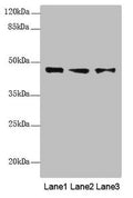 Western blot All lanes: RNF34 antibody at 1.18 ug/ml Lane 1: LO2 whole cell lysate Lane 2: U251 whole cell lysate Lane 3: Hela whole cell lysate Secondary Goat polyclonal to rabbit IgG at 1/10000 dilution Predicted band size: 42 kDa Observed band size: 42 kDa