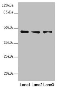 Western blot All lanes: RNF34 antibody at 1.18 ug/ml Lane 1: LO2 whole cell lysate Lane 2: U251 whole cell lysate Lane 3: Hela whole cell lysate Secondary Goat polyclonal to rabbit IgG at 1/10000 dilution Predicted band size: 42 kDa Observed band size: 42 kDa