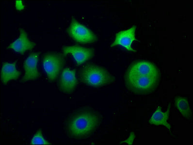 Immunofluorescence staining of A549 cells with CSB-PA856945LA01HU at 1:50, counter-stained with DAPI. The cells were fixed in 4% formaldehyde, permeabilized using 0.2% Triton X-100 and blocked in 10% normal Goat Serum. The cells were then incubated with the antibody overnight at 4°C. The secondary antibody was Alexa Fluor 488-congugated AffiniPure Goat Anti-Rabbit IgG(H+L).