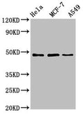 Western Blot
Positive WB detected in: Hela whole cell lysate, MCF-7 whole cell lysate, A549 whole cell lysate
All lanes: LCOR antibody at 4.6ug/ml
Secondary
Goat polyclonal to rabbit IgG at 1/50000 dilution
Predicted band size: 48, 45, 107 kDa
Observed band size: 48 kDa