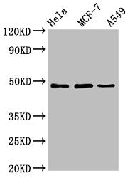 Western Blot
Positive WB detected in: Hela whole cell lysate, MCF-7 whole cell lysate, A549 whole cell lysate
All lanes: LCOR antibody at 4.6ug/ml
Secondary
Goat polyclonal to rabbit IgG at 1/50000 dilution
Predicted band size: 48, 45, 107 kDa
Observed band size: 48 kDa