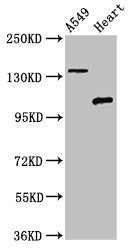 Western Blot
Positive WB detected in: A549 whole cell lysate, Rat heart tissue
All lanes: ADGRA2 antibody at 3ug/ml
Secondary
Goat polyclonal to rabbit IgG at 1/50000 dilution
Predicted band size: 143, 120, 20 kDa
Observed band size: 143, 120 kDa