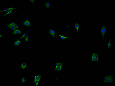 Immunofluorescence staining of HepG2 cells with CSB-PA857015OA01HU at 1:100, counter-stained with DAPI. The cells were fixed in 4% formaldehyde and blocked in 10% normal Goat Serum. The cells were then incubated with the antibody overnight at 4°C. The secondary antibody was Alexa Fluor 488-congugated AffiniPure Goat Anti-Rabbit IgG(H+L).