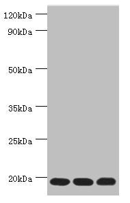 Western blot
All lanes: Thioredoxin, mitochondrial antibody at 3ug/ml
Lane 1: Mouse liver tissue
Lane 2: Rat brain tissue
Lane 3: Mouse kidney tissue
Secondary
Goat polyclonal to rabbit IgG at 1/10000 dilution
Predicted band size: 18 kDa
Observed band size: 18 kDa